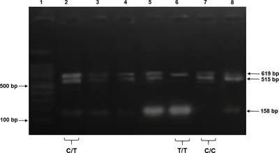 Biochemical association of regulatory variant of KLF14 genotype in the pathogenesis of cardiodiabetic patients